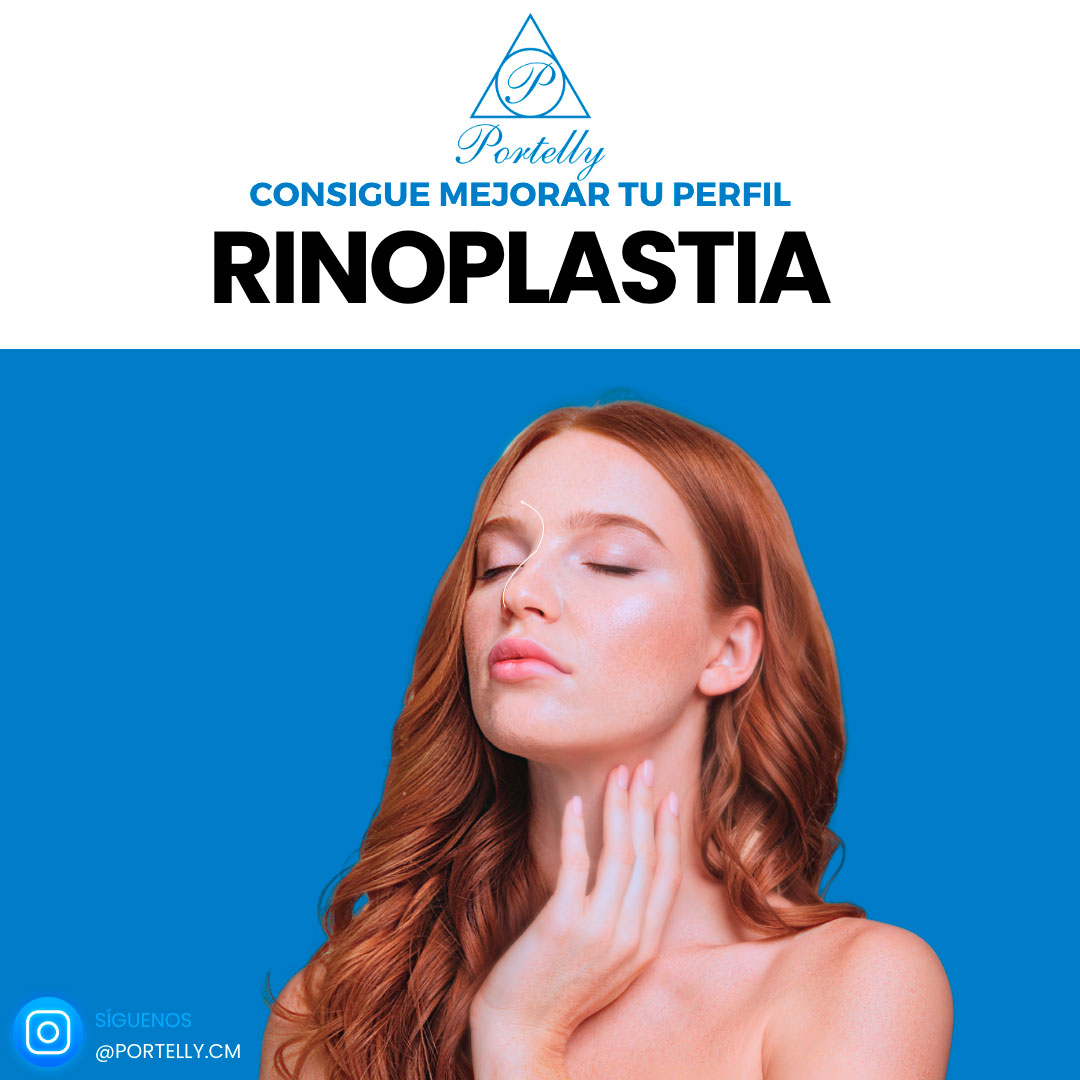 rinoplastia