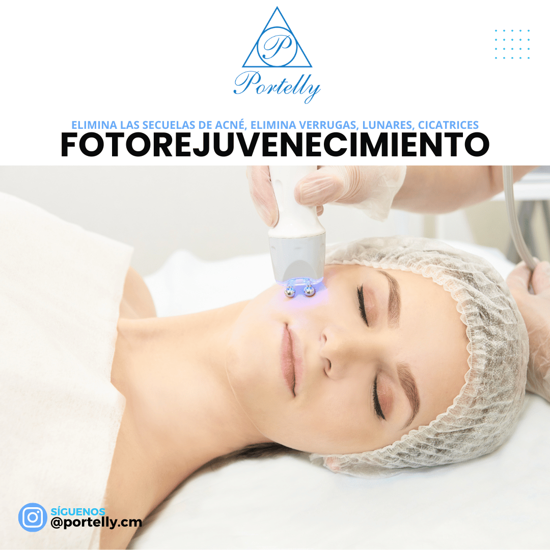 Diseños Gráficos (4)