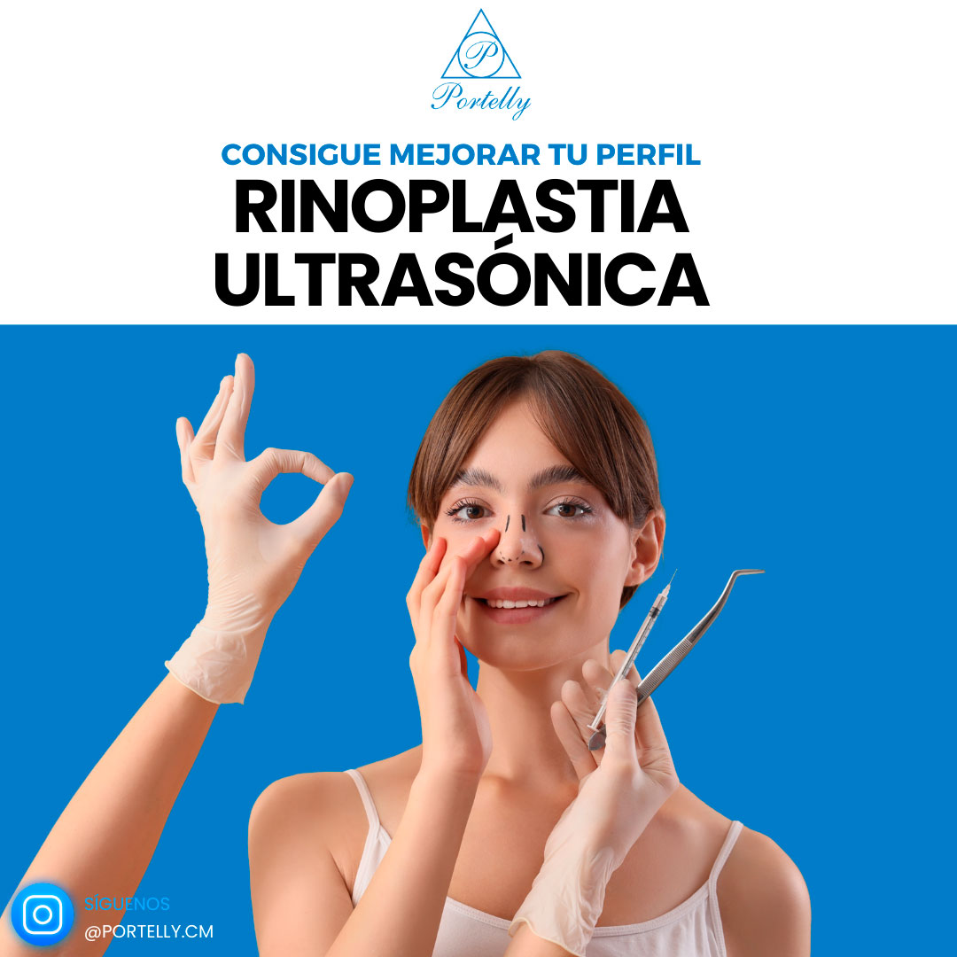 ultrasonica